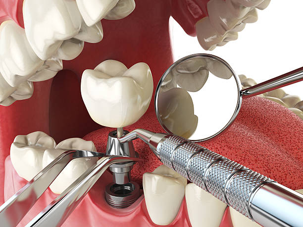 Best Pediatric Emergency Dentist in Nellysford, VA